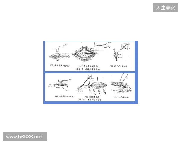 广州豹官方：杨浩眉弓伤口缝合30余针，预计5-7天后拆线